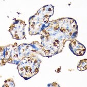 Anti-Hemoglobin subunit alpha (HBA1) antibody produced in rabbit