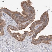 Anti-CAPN2 antibody produced in rabbit Prestige Antibodies&#174; Powered by Atlas Antibodies, affinity isolated antibody, buffered aqueous glycerol solution