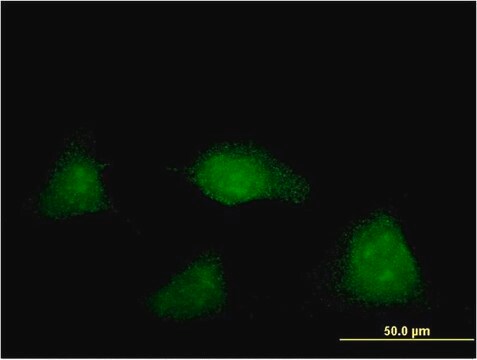 Monoclonal Anti-NUAK2 antibody produced in mouse clone 2F9, purified immunoglobulin, buffered aqueous solution