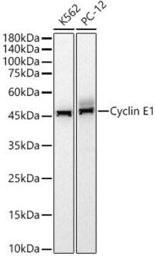 Anti-Cyclin E1 Antibody, clone 1L1W8, Rabbit Monoclonal