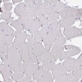 Anti-CDKN2B antibody produced in rabbit Prestige Antibodies&#174; Powered by Atlas Antibodies, affinity isolated antibody, buffered aqueous glycerol solution