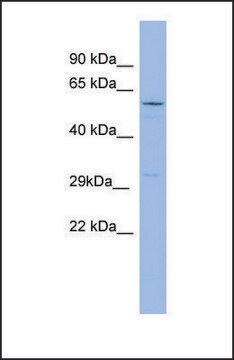 Anti-RRAD antibody produced in rabbit affinity isolated antibody