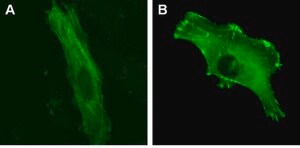 LentiBrite &#945;-actinin-GFP Lentiviral Biosensor