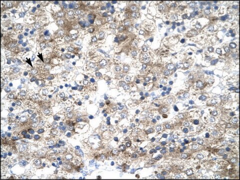 Anti-GTF2H1 antibody produced in rabbit IgG fraction of antiserum