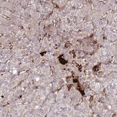 Anti-F2 antibody produced in rabbit Prestige Antibodies&#174; Powered by Atlas Antibodies, affinity isolated antibody, buffered aqueous glycerol solution