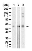 Anti-CRFR1/CRHR1 Antibody, clone 1N21 ZooMAb&#174; Rabbit Monoclonal recombinant, expressed in HEK 293 cells