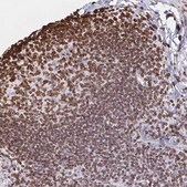 Anti-LMNB1 antibody produced in rabbit Prestige Antibodies&#174; Powered by Atlas Antibodies, affinity isolated antibody, buffered aqueous glycerol solution