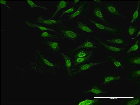 ANTI-PBK antibody produced in mouse clone 4D11, purified immunoglobulin, buffered aqueous solution