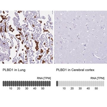 Anti-PLBD1 antibody produced in rabbit Prestige Antibodies&#174; Powered by Atlas Antibodies, affinity isolated antibody, buffered aqueous glycerol solution