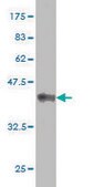 Monoclonal Anti-MAP2K5, (N-terminal) antibody produced in mouse clone 3E10, purified immunoglobulin, buffered aqueous solution