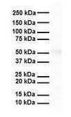 Anti-RARA antibody produced in rabbit affinity isolated antibody