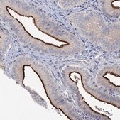 Anti-SLC9A3 antibody produced in rabbit Prestige Antibodies&#174; Powered by Atlas Antibodies, affinity isolated antibody, buffered aqueous glycerol solution