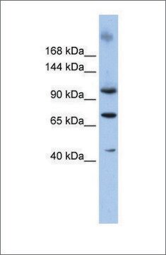 Anti-TUT1 antibody produced in rabbit affinity isolated antibody