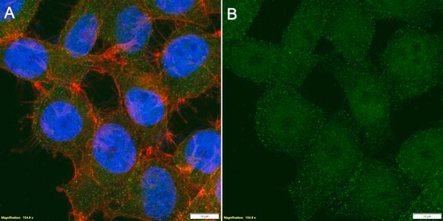 Anti-UBE3A Antibody, clone 1B9 ZooMAb&#174; Rabbit Monoclonal recombinant, expressed in HEK 293 cells
