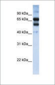 Anti-RARG antibody produced in rabbit affinity isolated antibody