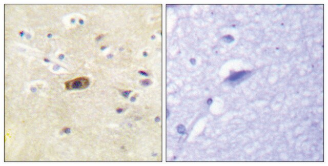 Anti-NMDAR2A antibody produced in rabbit affinity isolated antibody