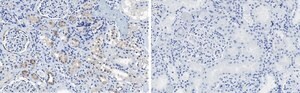 Anti-CDK6 Antibody, clone 2J3 ZooMAb&#174; Rabbit Monoclonal recombinant, expressed in HEK 293 cells
