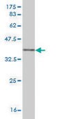 Monoclonal Anti-MMP13 antibody produced in mouse clone 3B11, purified immunoglobulin, buffered aqueous solution