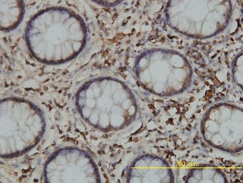 Monoclonal Anti-CALR antibody produced in mouse clone 1G11-1A9, purified immunoglobulin, buffered aqueous solution