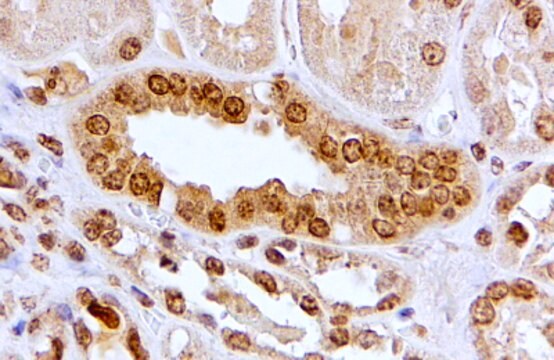 Anti-CAMK2A antibody produced in goat affinity isolated antibody, buffered aqueous solution