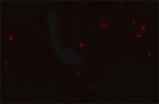 Anti-CRIM1 antibody produced in rabbit affinity isolated antibody, buffered aqueous solution