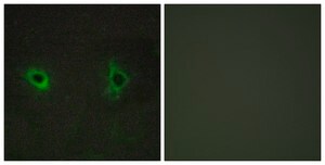 Anti-Collagen IV &#945;3 antibody produced in rabbit affinity isolated antibody