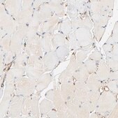 Anti-BCAP31 antibody produced in rabbit Prestige Antibodies&#174; Powered by Atlas Antibodies, affinity isolated antibody, buffered aqueous glycerol solution