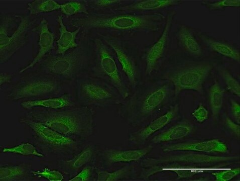 Anti-NARS antibody produced in rabbit purified immunoglobulin, buffered aqueous solution