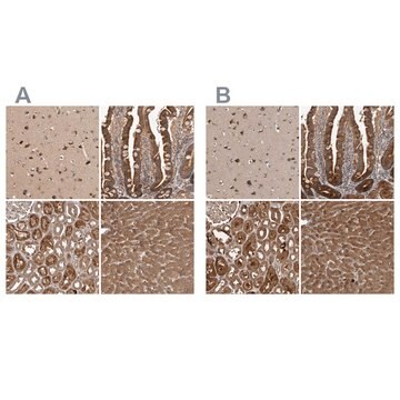 Anti-TRMT61B antibody produced in rabbit Prestige Antibodies&#174; Powered by Atlas Antibodies, affinity isolated antibody, buffered aqueous glycerol solution, Ab1