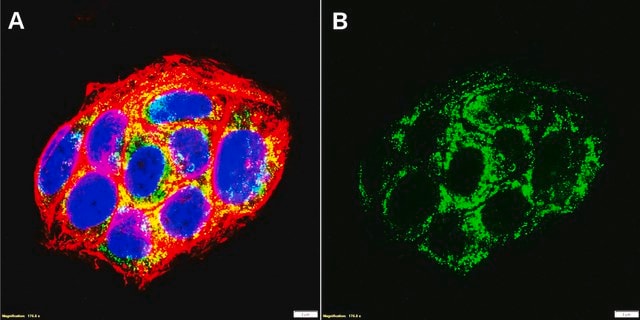 Anti-TGF &#946; receptor 1 Antibody, clone 4H18 ZooMAb&#174; Rabbit Monoclonal recombinant, expressed in HEK 293 cells