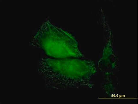 Anti-TMOD1 antibody produced in mouse purified immunoglobulin, buffered aqueous solution