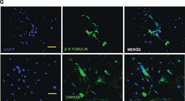 Anti-CNPase Antibody, clone 11-5B clone 11-5B, Chemicon&#174;, from mouse