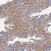Anti-ACTB antibody produced in rabbit Prestige Antibodies&#174; Powered by Atlas Antibodies, affinity isolated antibody, buffered aqueous glycerol solution