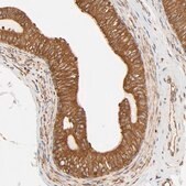 Anti-BCAP31 antibody produced in rabbit Prestige Antibodies&#174; Powered by Atlas Antibodies, affinity isolated antibody, buffered aqueous glycerol solution