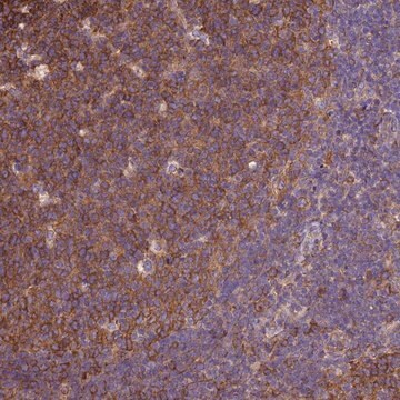 Anti-TUBB antibody produced in rabbit Prestige Antibodies&#174; Powered by Atlas Antibodies, affinity isolated antibody, buffered aqueous glycerol solution