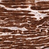 Monoclonal Anti-Tnnt2 Antibody Produced In Mouse Prestige Antibodies&#174; Powered by Atlas Antibodies, clone CL13403, affinity isolated antibody, buffered aqueous glycerol solution