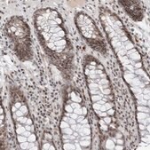 Anti-TRIM66 antibody produced in rabbit Prestige Antibodies&#174; Powered by Atlas Antibodies, affinity isolated antibody, buffered aqueous glycerol solution