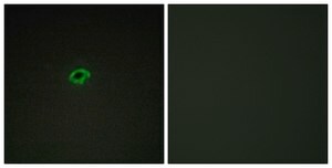 Anti-Collagen IV &#945;4 antibody produced in rabbit affinity isolated antibody