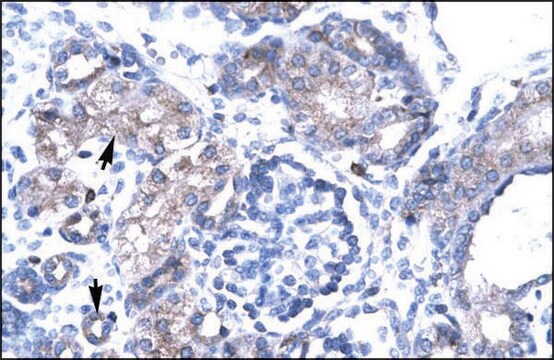 Anti-TBX19 antibody produced in rabbit IgG fraction of antiserum