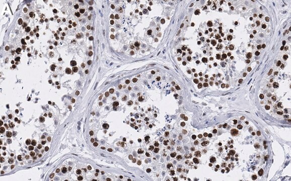 Anti-CBX1 Antibody, clone 1D7 ZooMAb&#174; Rabbit Monoclonal recombinant, expressed in HEK 293 cells