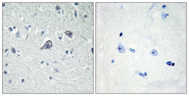 Anti-ADORA2A antibody produced in rabbit affinity isolated antibody