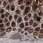 Anti-ASCC3 antibody produced in rabbit Prestige Antibodies&#174; Powered by Atlas Antibodies, affinity isolated antibody, buffered aqueous glycerol solution, ab2
