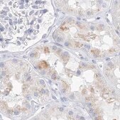 Anti-CSN1S1 antibody produced in rabbit Prestige Antibodies&#174; Powered by Atlas Antibodies, affinity isolated antibody, buffered aqueous glycerol solution