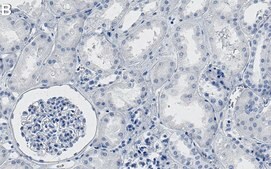 Anti-JAK1 Antibody, clone 1I13 ZooMAb&#174; Rabbit Monoclonal recombinant, expressed in HEK 293 cells