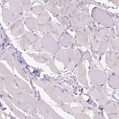 Anti-CD40 antibody produced in rabbit Prestige Antibodies&#174; Powered by Atlas Antibodies, affinity isolated antibody, buffered aqueous glycerol solution