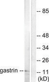 Anti-Gastrin antibody produced in rabbit affinity isolated antibody