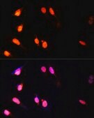 Anti-SETD2 antibody produced in rabbit