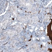 Monoclonal Anti-AFP antibody produced in mouse Prestige Antibodies&#174; Powered by Atlas Antibodies, clone CL9766, purified immunoglobulin, buffered aqueous glycerol solution