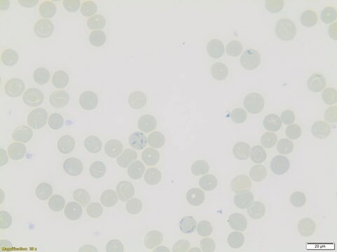 Reticulocyte Stain