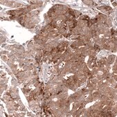 Monoclonal Anti-Lgr5 Antibody Produced In Mouse Prestige Antibodies&#174; Powered by Atlas Antibodies, clone CL13567, affinity isolated antibody, buffered aqueous glycerol solution